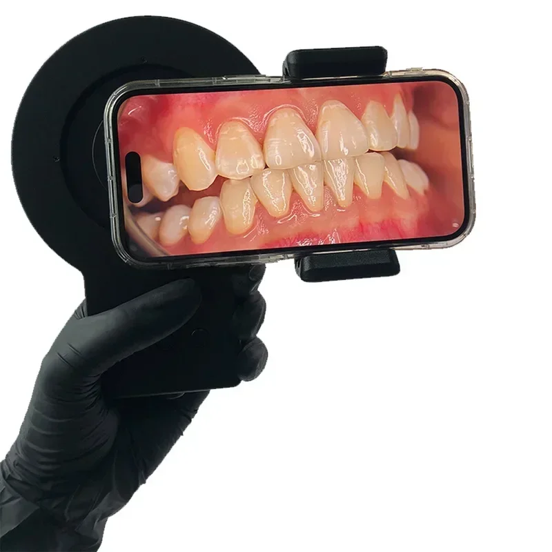 풀 메디컬 MK023 치과 사진 촬영 장비 구강 휴대폰 - Photography Lighting Diy 리뷰 및 가격